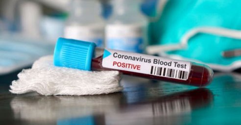 В Харькове – 717 новых случаев заболевания коронавирусом