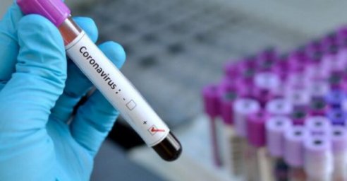 В Харьковской области - пять больных коронавирусом