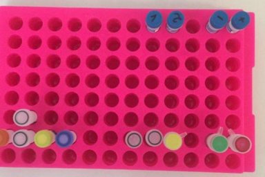 Проверку подозрений на COVID-19 ускорят