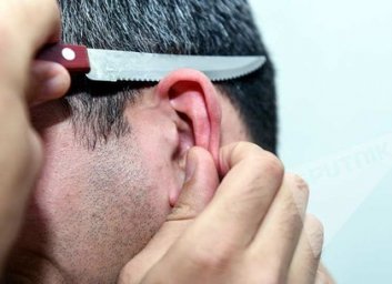 В малиновке дебоширы не ограничились дракой и отрезали односельчанину уши