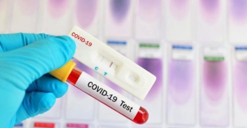 В Харькове зафиксировано около 1 350 случаев заболевания коронавирусом