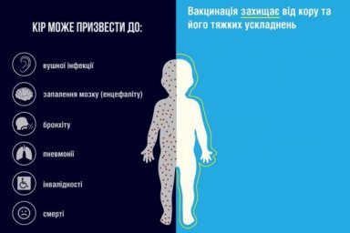 71,9% детей до года в Украине вакцинированы от кори